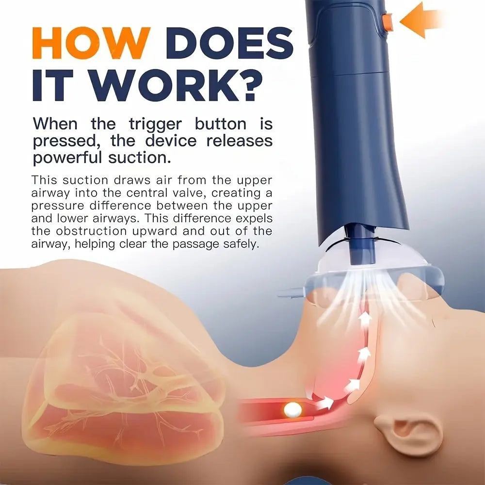 1 Heimlich Anti-Choking Device | Throat Negative Pressure Suction Device, Household Portable Automatic First Aid, Reusable, Mixed Color, PP Material Dropshipman